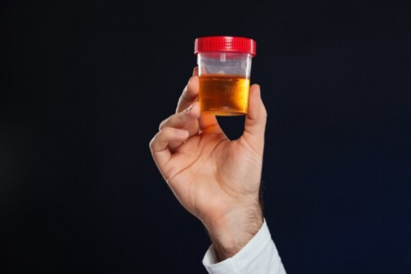 Chá de aroeira para infecção urinária